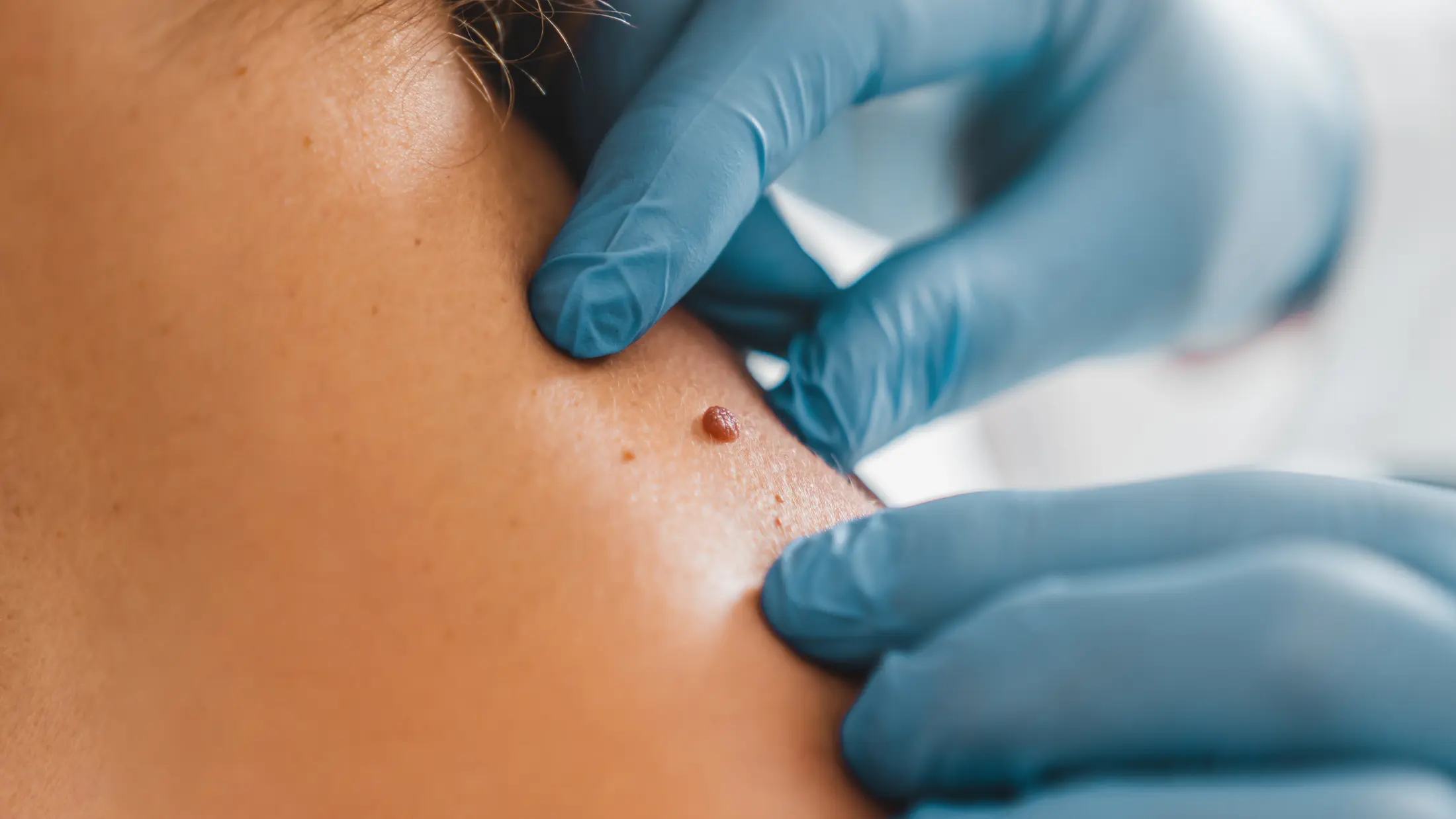 Offer Dermatology Financing to Your Patients