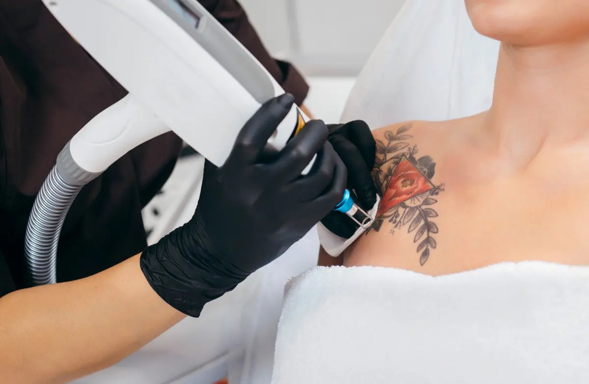 Professional removing tattoo